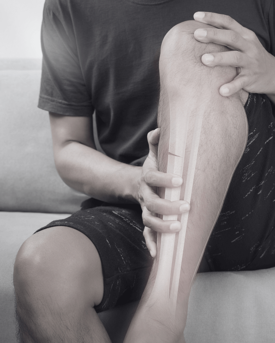 Man sieht den unteren Körper einer sitzenden Person. ein Bein ist angewinkelt und von beiden Händen gehalten. Der Knochen des Schienbeins ist durch eine weiße Hervorhebung sichtbar.